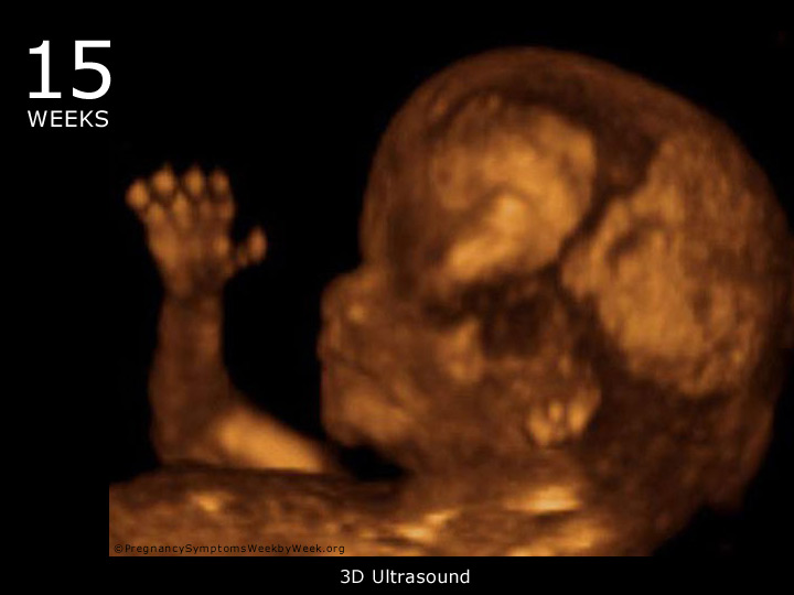 What to Expect in Ultrasound Done at 15 Weeks Pregnant